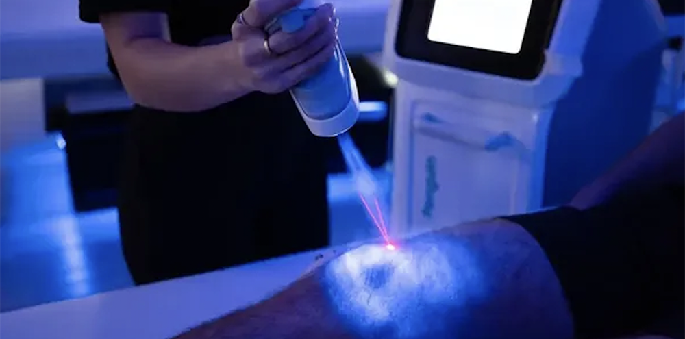 Local Cryotherapy